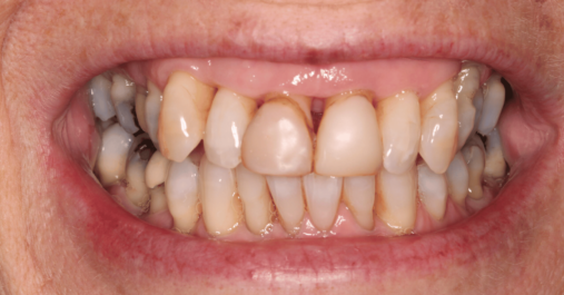 Before - Springmount Dental